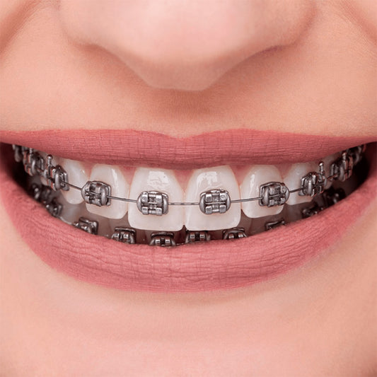 Advance Series MBT (100 Case)