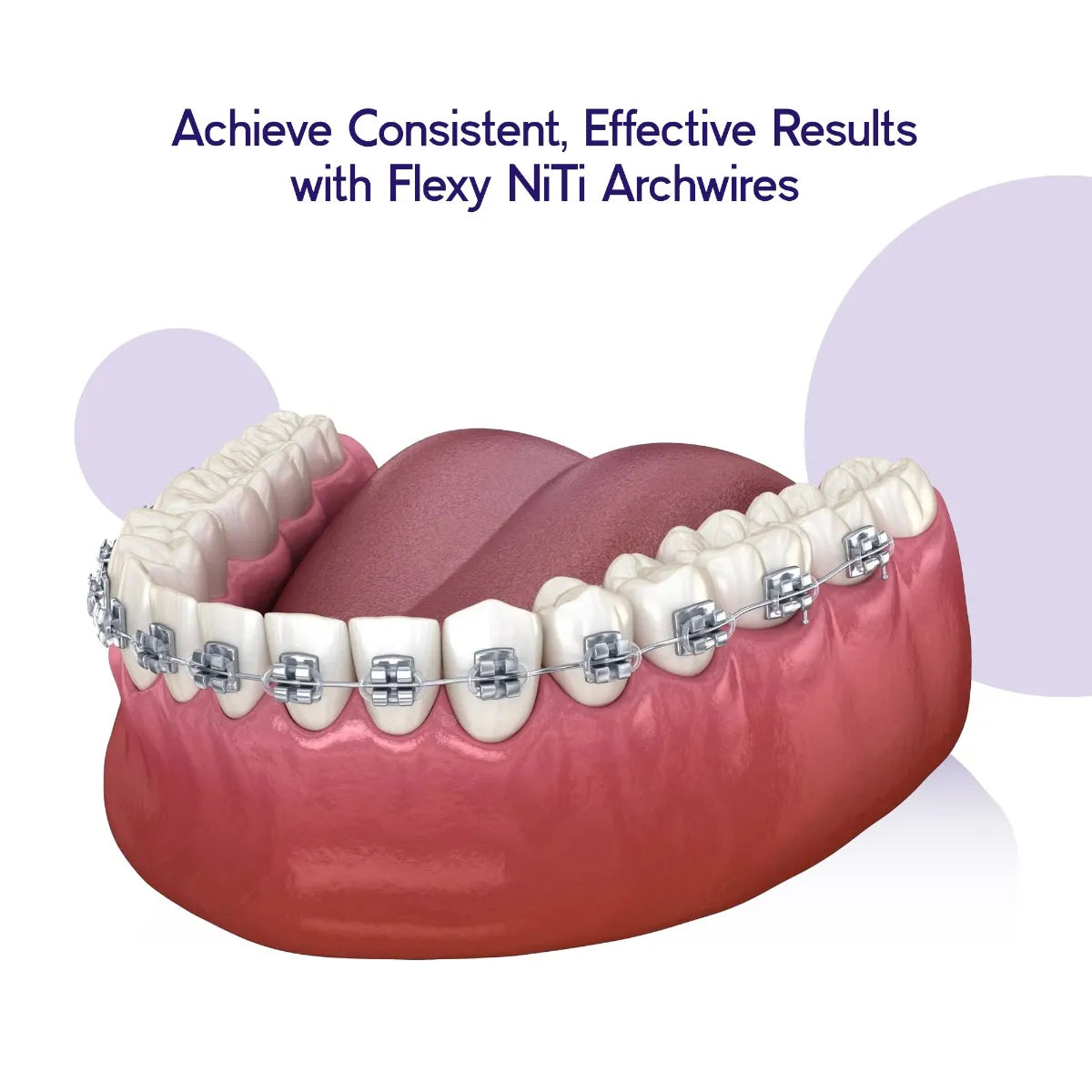 Flexy NITI Reverse Curve ArchWire (10 Round)