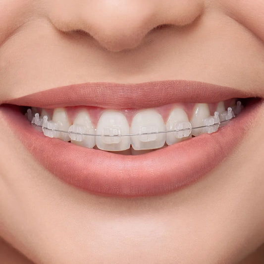 Flexy NiTi Super Elastic (10 Rectangular)